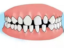 牙齿修复哪家正规型号齐全